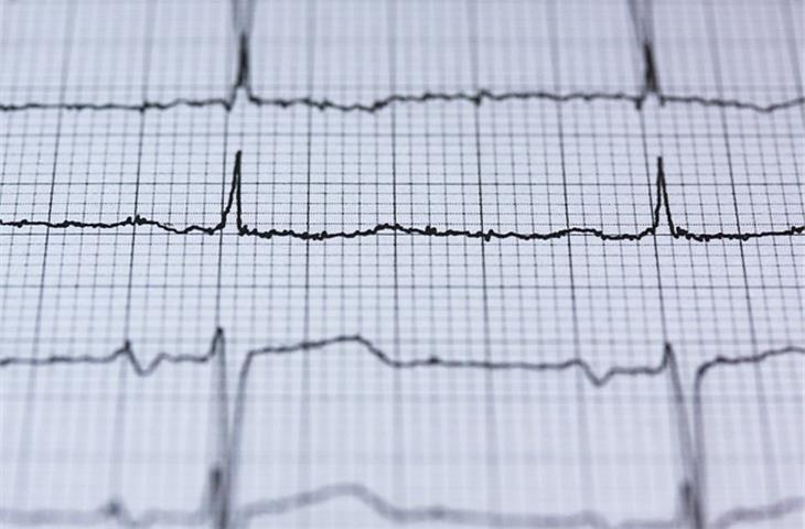 ECG monitoring equipment